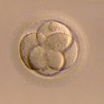体外受精の移植スケジュール！２回目はクロミッド＆新鮮分割胚【40代KLC通院ブログ】
